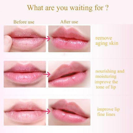 10pcs Golden Lip Masks