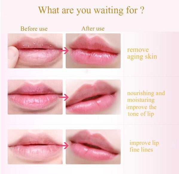 10pcs Golden Lip Masks