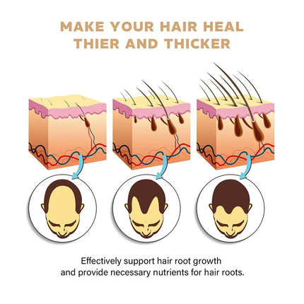 Shampooing anti-chute de cheveux : favorise la croissance, renforce les racines, répare le cuir chevelu, anti-amincissement et hydratation. Soin capillaire épaississant.